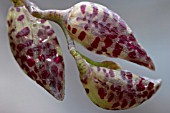 PLEUROTHALLIS RESTREPIOIDES,  DRAGON STONE